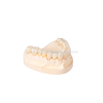 Advanced Multilayer Zirconia in 3D Dental Restoration Applications